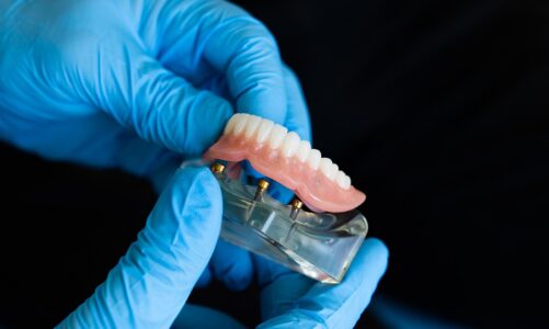 Cristal Lab, l’acteur du numérique dentaire