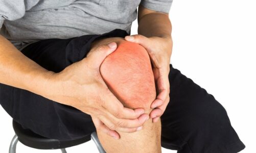 Quel médicament est conseillé pour soulager l’arthrose ?