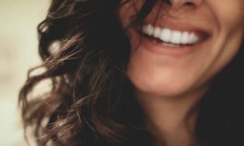 sourire femme dents